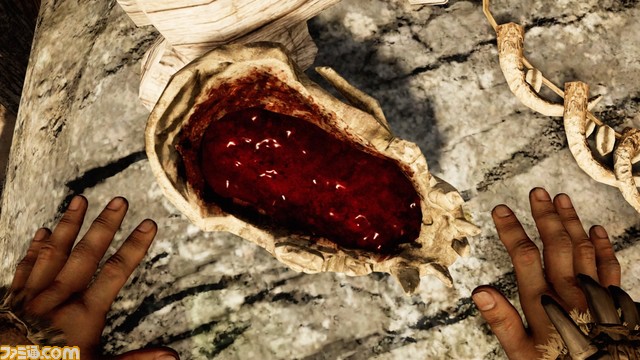 １B